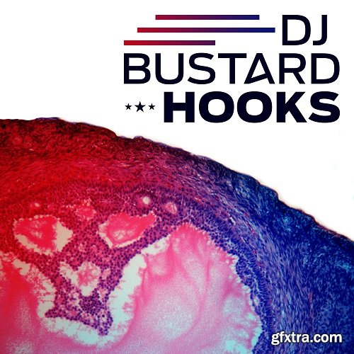 Diginoiz Dj Bustard Hooks WAV MiDi-DISCOVER