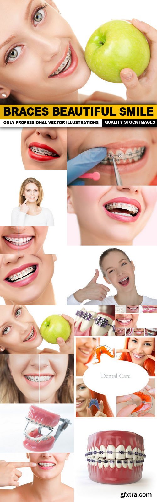 Braces Beautiful Smile - 15 HQ Images