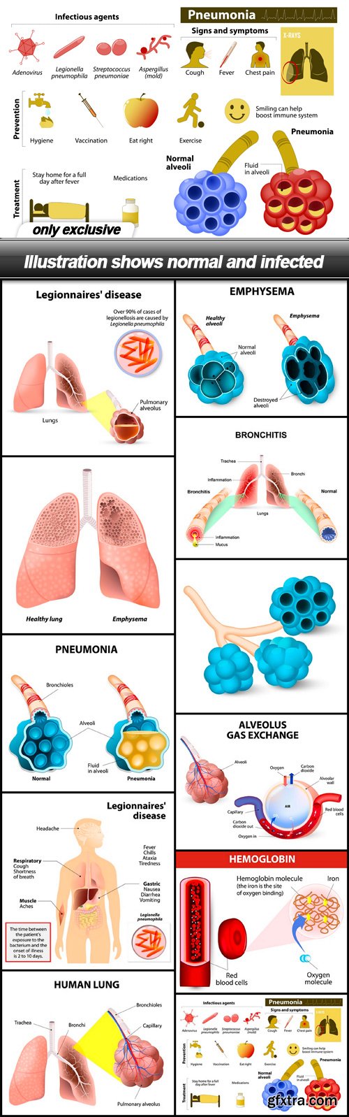 Illustration shows normal and infected - 11 EPS