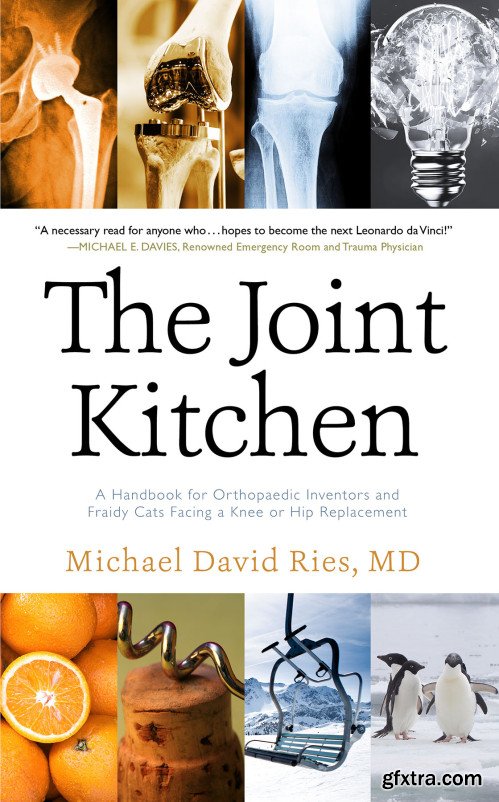 The Joint Kitchen: A Handbook for Orthopaedic Inventors and Fraidy Cats Facing a Knee or Hip Replacement