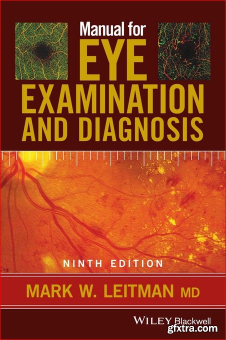 Manual for Eye Examination and Diagnosis 9th Edition