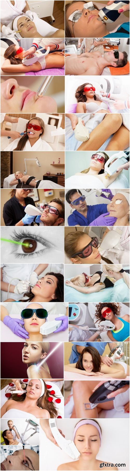 Different laser correction procedures 25 HQ Jpeg