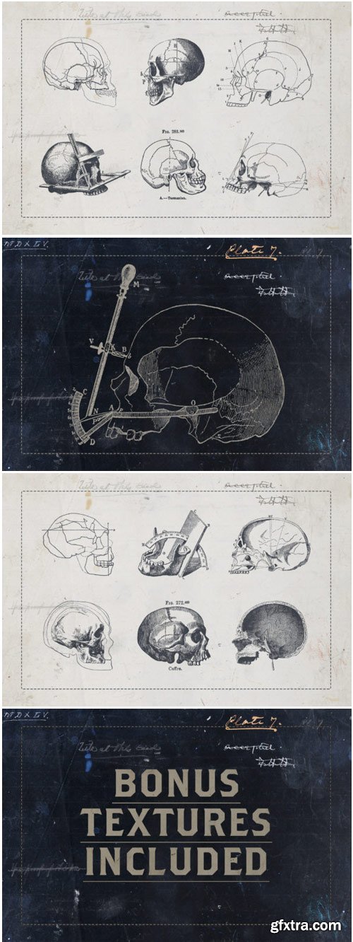 Craniometry 1761160