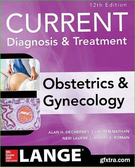 Current Diagnosis & Treatment Obstetrics & Gynecology, 12th Edition