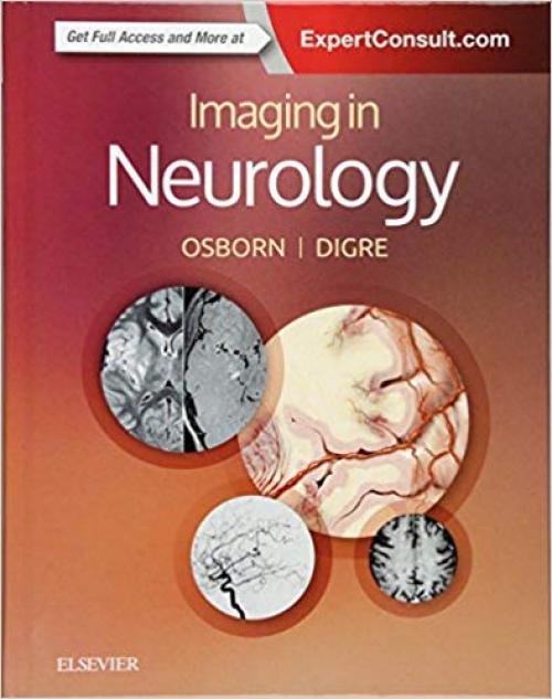 Imaging in Neurology - 0323447813