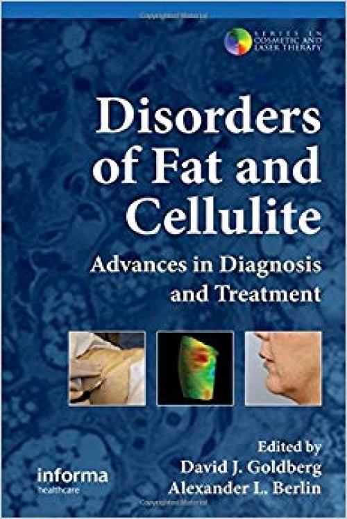 Disorders of Fat and Cellulite: Advances in Diagnosis and Treatment (Series in Cosmetic and Laser Therapy) - 041547700X