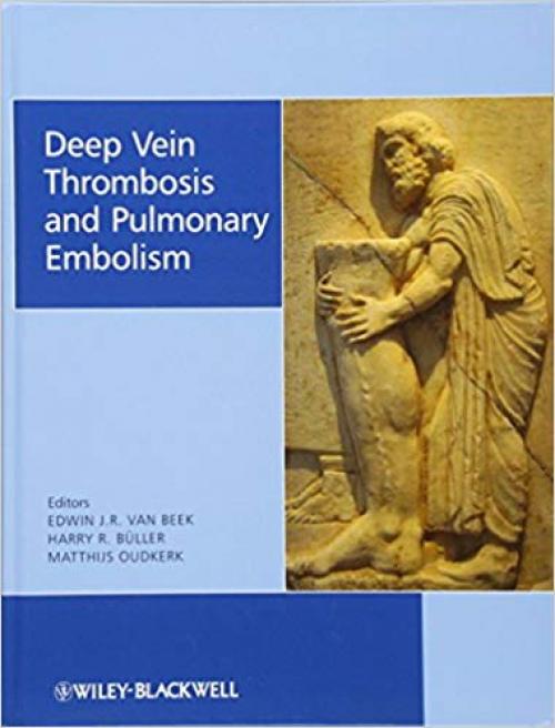 Deep Vein Thrombosis and Pulmonary Embolism - 0470517174