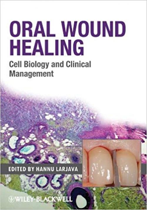 Oral Wound Healing: Cell Biology and Clinical Management - 0813804817