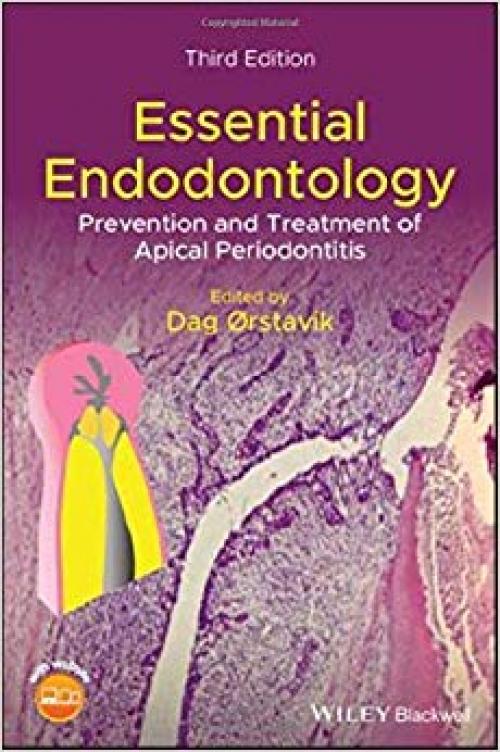 Essential Endodontology: Prevention and Treatment of Apical Periodontitis - 1119271959