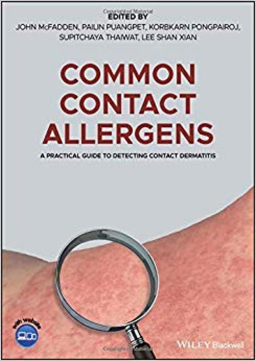 Common Contact Allergens: A Practical Guide to Detecting Contact Dermatitis - 1119405661