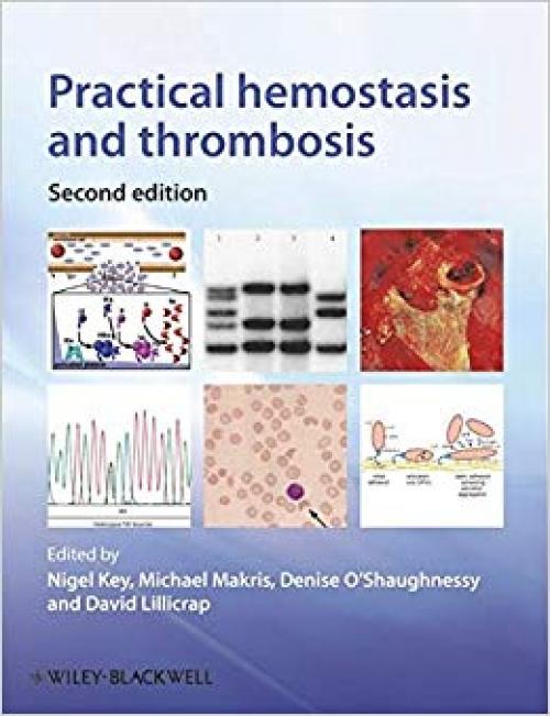 Practical Hemostasis and Thrombosis - 1405184604