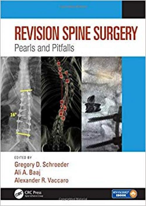 Revision Spine Surgery: Pearls and Pitfalls - 1498773826