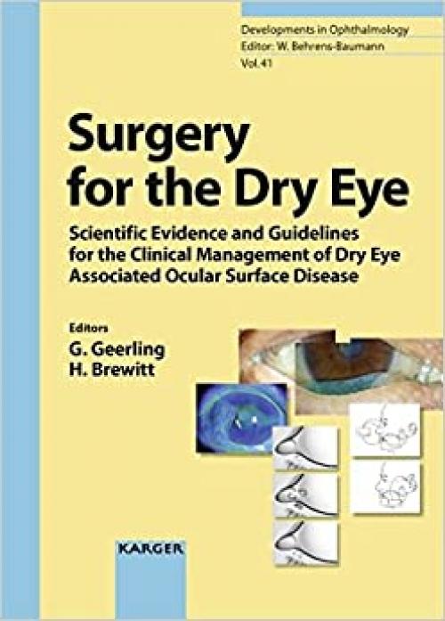 Surgery for the Dry Eye: Scientific Evidence and Guidelines for the Clinical Management of Dry Eye Associated Ocular Surface Disease (Developments in Ophthalmology, Vol. 41) - 3805583761