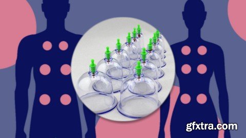 Understanding Cupping Therapy - The Basics