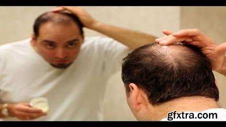 Natural Remedies To Treat Hair Loss. You Should Try