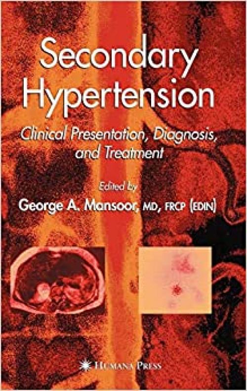  Secondary Hypertension: Clinical Presentation, Diagnosis, and Treatment (Clinical Hypertension and Vascular Diseases) 