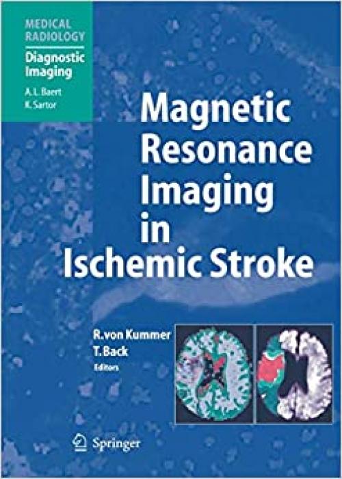  Magnetic Resonance Imaging in Ischemic Stroke (Medical Radiology) 