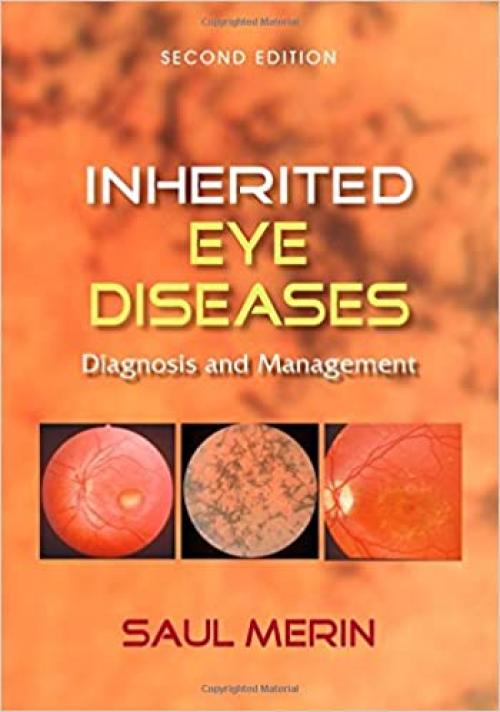  Inherited Eye Diseases: Diagnosis and Management 