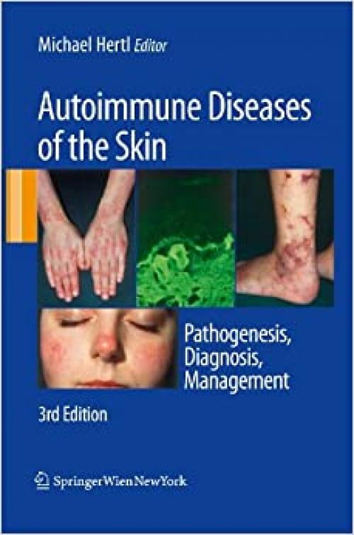  Autoimmune Diseases of the Skin: Pathogenesis, Diagnosis, Management 