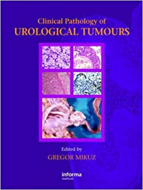  Clinical Pathology of Urological Tumours 