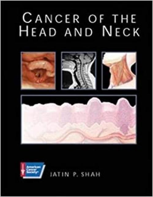  Cancer of the Head and Neck (Acs Atlas of Clinical Oncology) 