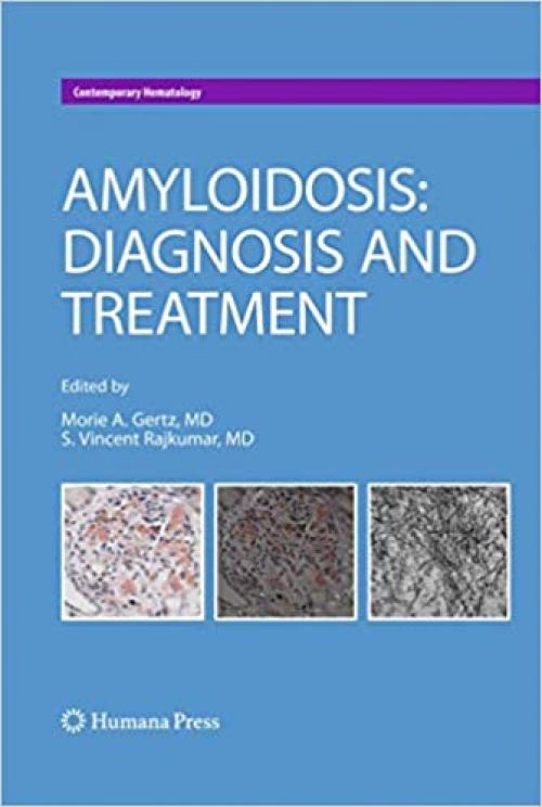  Amyloidosis: Diagnosis and Treatment (Contemporary Hematology) 