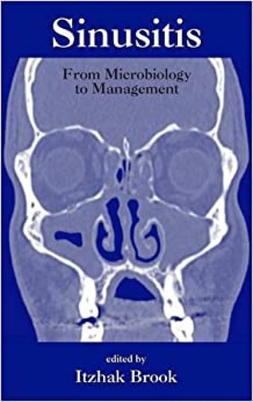  Sinusitis: From Microbiology To Management (Infectious Disease and Therapy) 