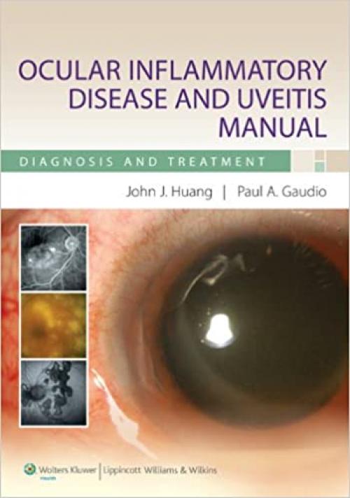  Ocular Inflammatory Disease and Uveitis Manual: Diagnosis and Treatment 