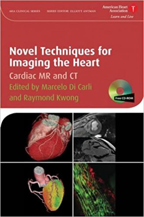  Novel Techniques for Imaging the Heart: Cardiac MR and CT 