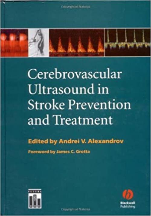  Cerebrovascular Ultrasound in Stroke Prevention and Treatment 