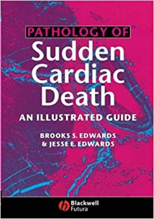  Pathology of Sudden Cardiac Death: An Illustrated Guide 