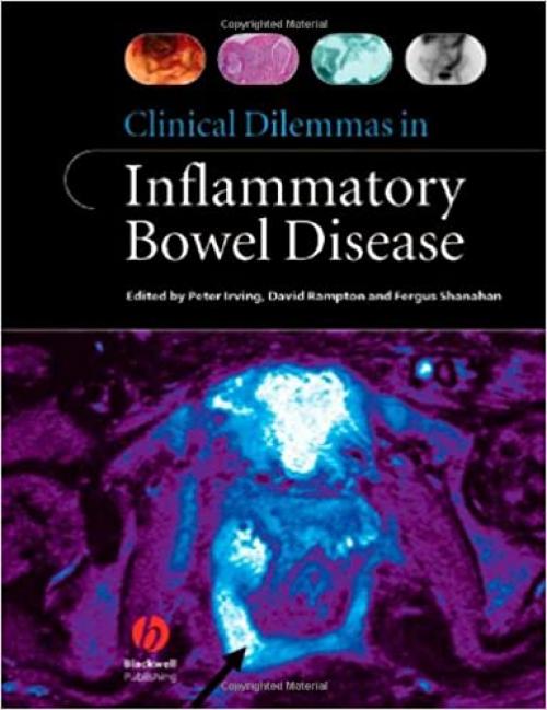  Clinical Dilemmas in Inflammatory Bowel Disease 