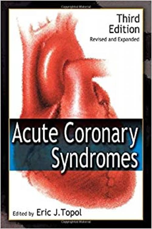  Acute Coronary Syndromes (Fundamental and Clinical Cardiology) 