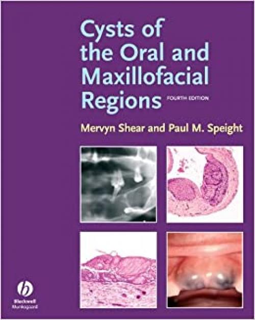  Cysts of the Oral and Maxillofacial Regions 