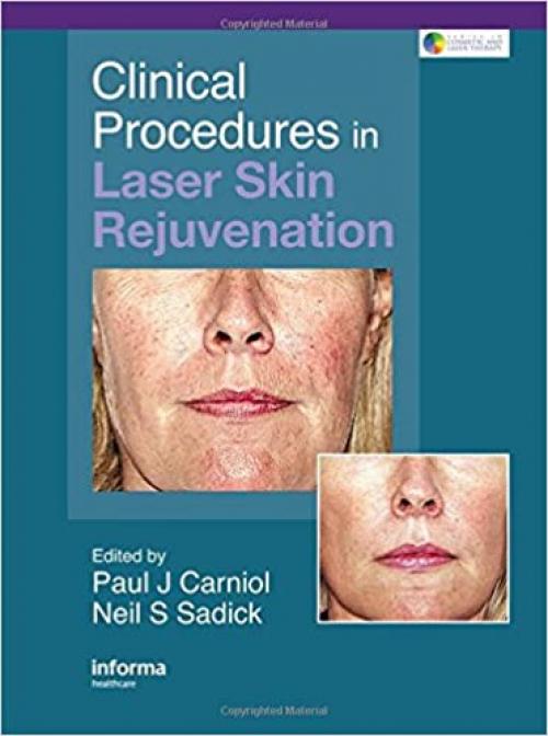  Clinical Procedures in Laser Skin Rejuvenation (Series in Cosmetic and Laser Therapy) 