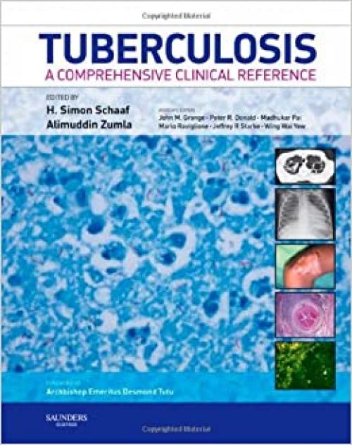  Tuberculosis: A Comprehensive Clinical Reference 