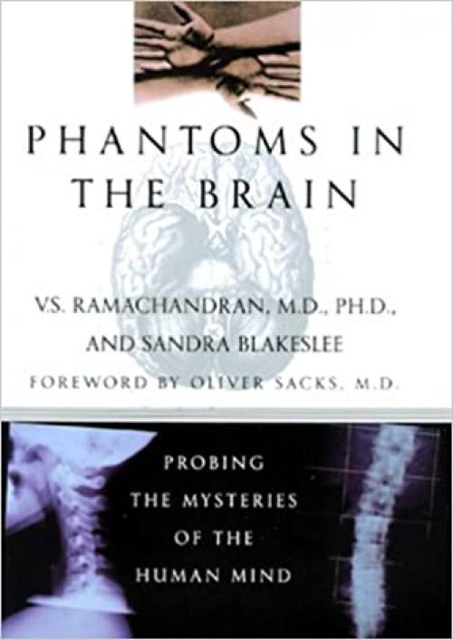  Phantoms in the Brain: Probing the Mysteries of the Human Mind 