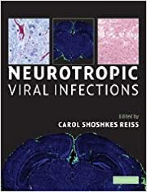  Neurotropic Viral Infections 