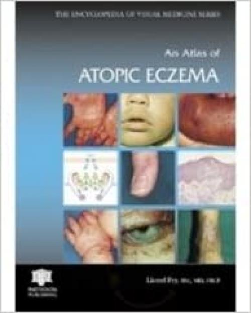  An Atlas of Atopic Eczema 