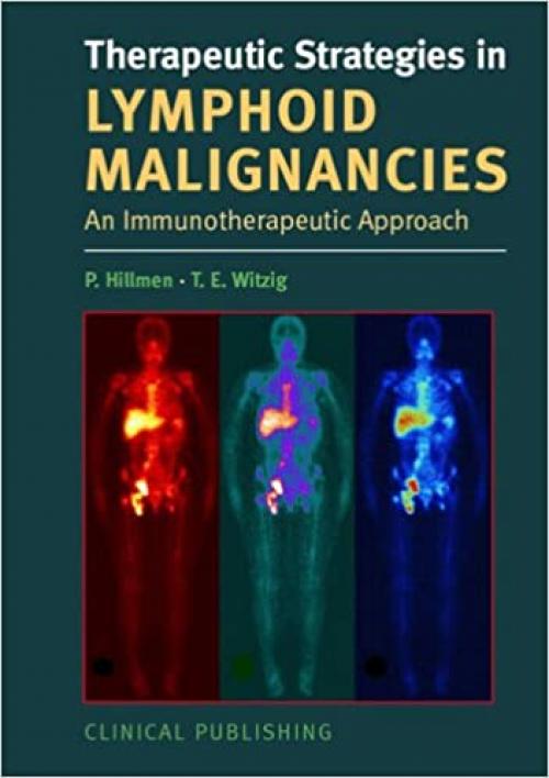  Therapeutic Strategies in Lymphoid Malignancy: An Immunotherapeutic Approach 