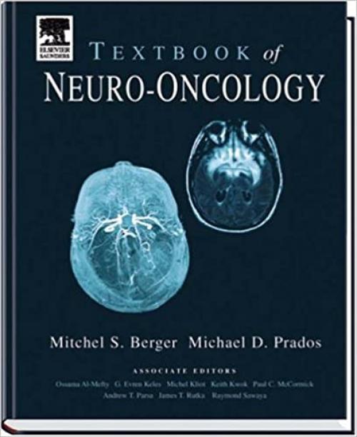  Textbook of Neuro-Oncology 