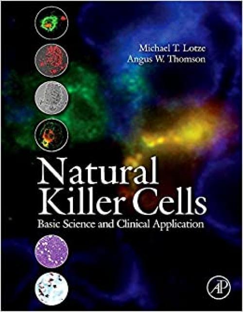  Natural Killer Cells: Basic Science and Clinical Application 