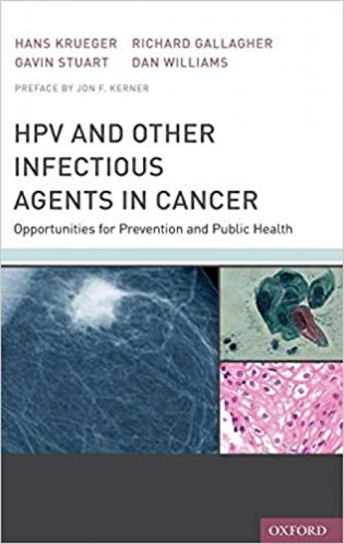  HPV and Other Infectious Agents in Cancer: Opportunities for Prevention and Public Health 