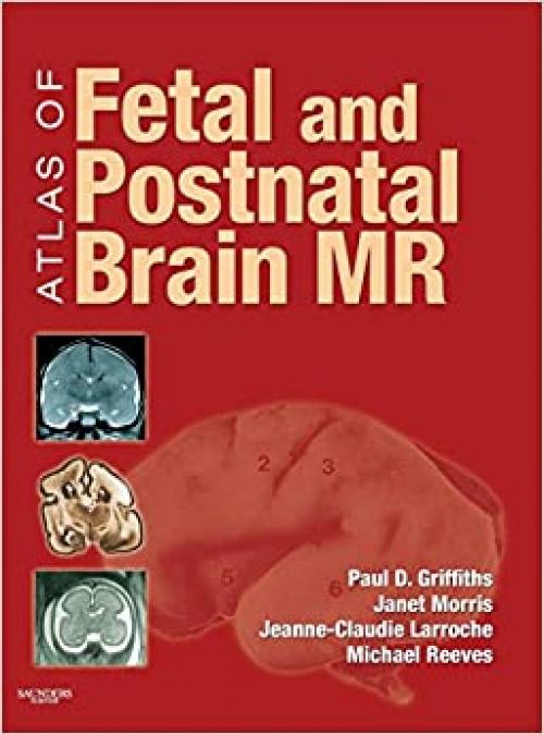  Atlas of Fetal and Postnatal Brain MR 