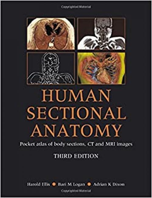  Human Sectional Anatomy: Atlas of Body Sections, CT and MRI Images 