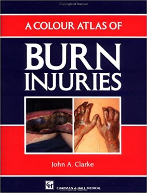  A Colour Atlas of Burn Injuries (Medical Atlas Series) 