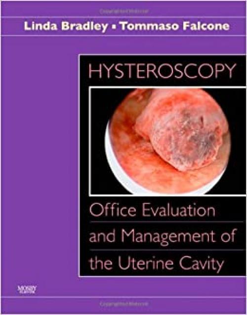  Hysteroscopy: Office Evaluation and Management of the Uterine Cavity: Text with DVD-ROM 