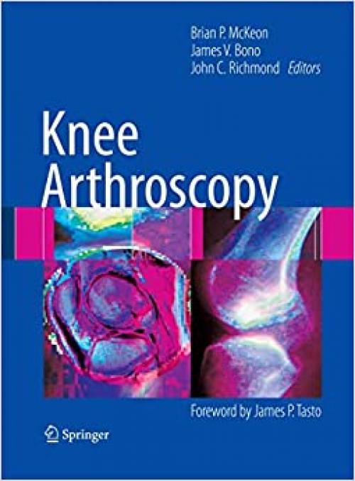  Knee Arthroscopy 