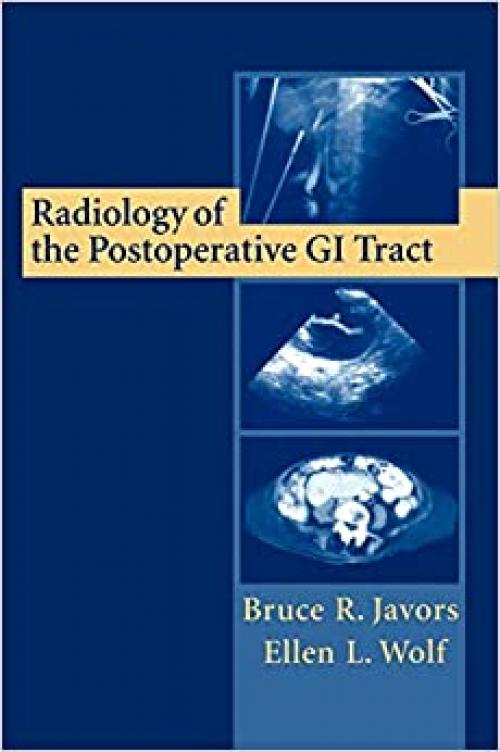  Radiology of the Postoperative GI Tract 