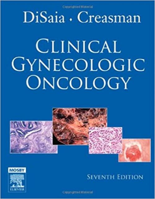  Clinical Gynecologic Oncology (Clinical Gynecologic Cncology) 